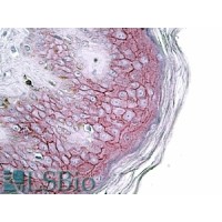 Immunohistochemistry (3.8μg/ml) staining of paraffin embedded Human Skin. Steamed antigen retrieval with citrate buffer pH 6, AP-staining.