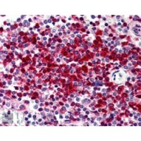 Immunohistochemistry (5μg/ml) staining of paraffin embedded Human Spleen. Steamed antigen retrieval with citrate buffer pH 6, AP-staining.