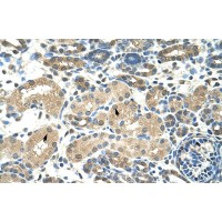 Antibody used in IHC on Human kidney.