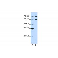 Antibody used in WB on Human HepG2 at 1.25 ug/ml.