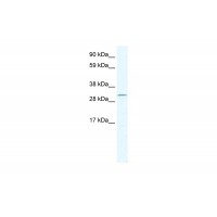 Antibody used in WB on Mouse SP2/0 at 2.5 ug/ml.