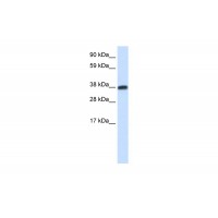 Antibody used in WB on Human Testis at 0.2-1 ug/ml.