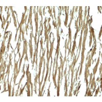 Immunohistochemistry of DNAJC13 in human heart tissue with DNAJC13 antibody at 5 μg/mL.