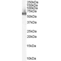 Western Blot staining (0.1μg/ml) of Human PBMC lysate (RIPA buffer, 35μg total protein per lane). Primary incubated for 1 hour. Detected by western blot using chemiluminescence.
