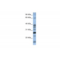 Antibody used in WB on Human 721_B at 0.2-1 ug/ml.