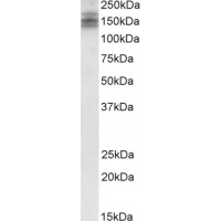 Western Blot (2μg/ml) staining of Human Brain (CerWestern Blot ) lysate (35μg protein in RIPA buffer). Primary incubation was 1 hour. Detected by chemiluminescence.