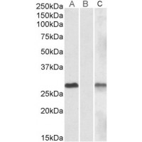 Lane A - antibody (1μg/ml) staining of HEK293 overexpressing Human DYDC1 lysate (10μg protein in RIPA buffer) Lane B - antibody (1μg/ml) staining of HEK293 mock-transfected lysate (10μg protein in RIPA buffer). Lane C - antibody anti-MYC Tag (1/1000) stainin