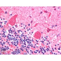 Immunohistochemistry (2.5μg/ml) staining of paraffin embedded Human CerImmunohistochemistry . Steamed antigen retrieval with citrate buffer pH 6, AP-staining.