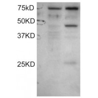 Western Blot staining (0.1μg/ml) of COS1 cell lysates: untransfected (left lane) and transfected with full length recombinant Human DYX1C1 (right lane). Data kindly provided by Wang and LoTurco, University of Connecticut, USA.