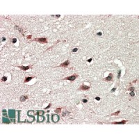 Immunohistochemistry (5μg/ml) staining of paraffin embedded Human CerImmunohistochemistry ortex. Steamed antigen retrieval with citrate buffer pH 6, AP-staining.