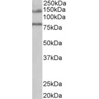 Western Blot (1μg/ml) staining of Human Brain (Hippocampus) lysate (35μg protein in RIPA buffer). Primary incubation was 1 hour. Detected by chemiluminescence.