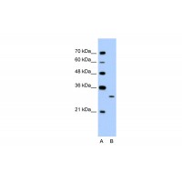 Antibody used in WB on Human Jurkat 1.25 ug/ml.