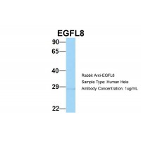 Antibody used in WB on Human Hela at 1 ug/ml.