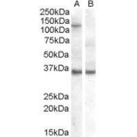 HEK293 overexpressing EIF2C1 and probed with antibody (non-transfected HEK293 in lane B).