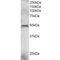 Western Blot staining (3μg/ml) of NCI-H460 lysate (RIPA buffer, 30μg total protein per lane). Primary incubated for 1 hour. Detected by western blot using chemiluminescence.