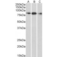 Western Blot (0.3μg/ml) staining of Human Frontal Cortex (A), Mouse (B) and Rat (C) Brain lysate (35μg protein in RIPA buffer). Primary incubation was 1 hour. Detected by chemiluminescence.