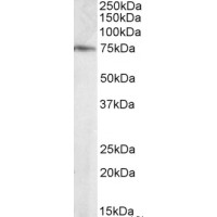 Western Blot staining (0.1μg/ml) of Human Brain (Hipoocampus) lysate (RIPA buffer, 35μg total protein per lane). Primary incubated for 1 hour. Detected by chemiluminescence.