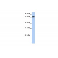 Antibody used in WB on Human Brain at 0.2-1 ug/ml.