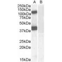 Western Blot (0.1μg/ml) staining of Human Brain (CerWestern Blot ) lysate (35μg protein in RIPA buffer) with (B) and without (A) blocking with the immunising peptide. Primary incubation was 1 hour. Detected by chemiluminescence.