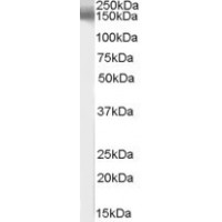 Western Blot (1μg/ml) staining of Human Brain lysate (35μg protein in RIPA buffer). Primary incubation was 1 hour. Detected by chemiluminescence.