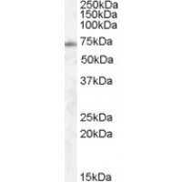 Western Blot (0.5μg/ml) staining of Human Lung lysate (35μg protein in RIPA buffer). Primary incubation was 1 hour. Detected by chemiluminescence.