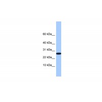 Antibody used in WB on Human 721_B at 0.2-1 ug/ml.