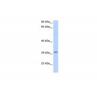 Antibody used in WB on Human Brain at 0.2-1 ug/ml.
