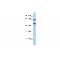Antibody used in WB on Human Muscle at 0.2-1 ug/ml.