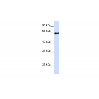 Antibody used in WB on Human 293T at 0.2-1 ug/ml.