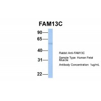 Antibody used in WB on Hum. Fetal Muscle at 1 ug/ml.