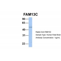 Antibody used in WB on Hum. Fetal Brain at 1 ug/ml.
