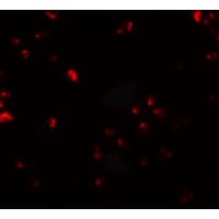 Immunofluorescence of FAM193B in Jurkat cells with FAM193B antibody at 20 μg/mL.