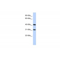 Antibody used in WB on Human HepG2 at 0.2-1 ug/ml.