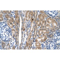 Antibody used in IHC on Human kidney.