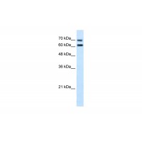 Antibody used in WB on Human Jurkat 5.0 ug/ml.