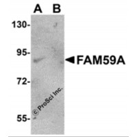 Western blot analysis of FAM59A in rat liver tissue lysate with FAM59A antibody at 1 μg/mL in (A) the absence and (B) the presence of blocking peptide.