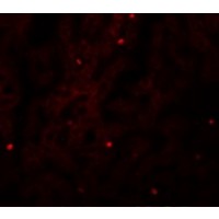 Immunofluorescence of FAM59A in Human Liver cells with FAM59A antibody at 20 μg/mL.