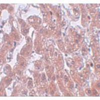 Immunohistochemistry of PLEKHM3 in human brain tissue with PLEKHM3 antibody at 5 μg/mL.
