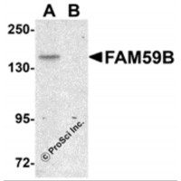 Western blot analysis of FAM59B in SK-N-SH cell lysate with FAM59B antibody at 1 μg/mL in (A) the absence and (B) the presence of blocking peptide.
