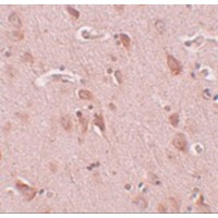 Immunohistochemistry of FAM59B in human brain tissue with FAM59B antibody at 5 μg/mL.