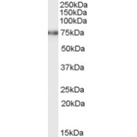 Western Blot (0.5μg/ml) staining of rat kidney lysate (RIPA buffer, 35μg total protein per lane). Primary incubated for 1 hour. Detected by western blot using chemiluminescence.