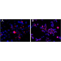 Immunoflorescence (2.5ug/ml overnight staining of cell lines OPCT-1 (A) and MDA468 (fB) with Alexa Fluor 568 (red) and nuclear counter staining with DAPI (blue). Data kindly provided by Dr S, McArdle, and obtained by Sumanjeet Malhi , John van Geest Research Centr