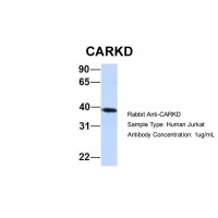Antibody used in WB on Human Jurkat 1 ug/ml.
