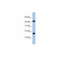 Antibody used in WB on Human Heart at 0.2-1 ug/ml.