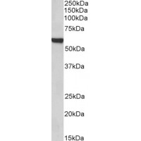 Immunohistochemistry (1μg/ml) staining of Rat Lung lysate (35μg protein in RIPA buffer). Primary incubation was 1 hour. Detected by chemiluminescence