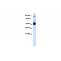 Antibody used in WB on Mouse SP2/0 at 0.2-1 ug/ml.