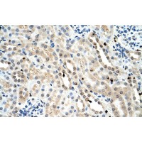 Antibody used in IHC on Mouse Kidney.