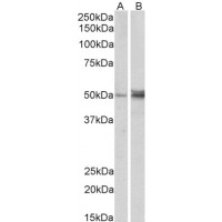 Western blot (1 μg/ml) staining of Human (A) and Mouse (B) Ovary lysate (35 μg protein in RIPA buffer). Primary incubation was 1 hour. Detected by chemiluminescence