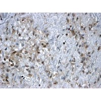 Immunohistochemistry (2 μg/ml) staining of paraffin embedded Human Ovary. Steamed antigen retrieval with citrate buffer pH 6, HRP-staining.