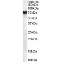 Western Blot (1μg/ml) staining of human pancreas lysate (35μg protein in RIPA buffer). Primary incubation was 1 hour. Detected by chemiluminescence.